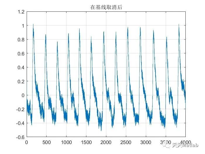 【信号去噪】基于小波变换实现脉搏信号去噪附Matlab代码