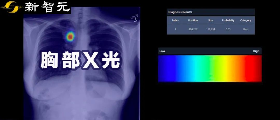 放射科医生再临危机！国外五大机构联合发布「胸部X光」最新基准