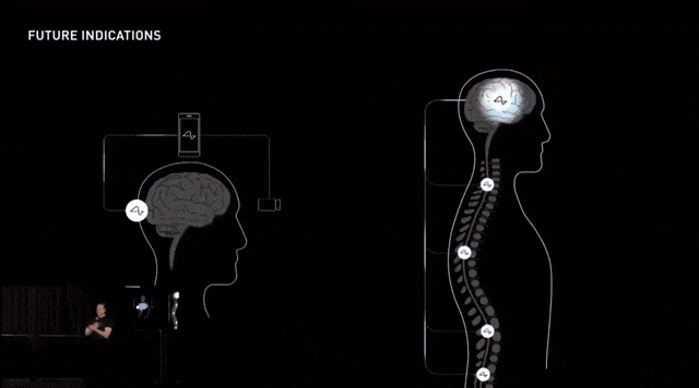 马斯克Neuralink首个芯片植入人脑，意念操控手机成真！人类进入「义体」时代