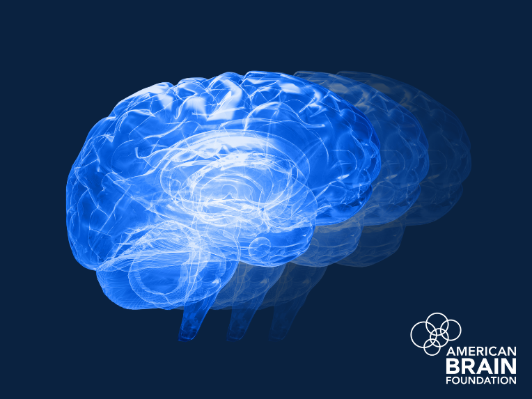 Brain Aging Explained: What Speeds It Up, and What We Can Do to Prolong  Brain Health - American Brain Foundation