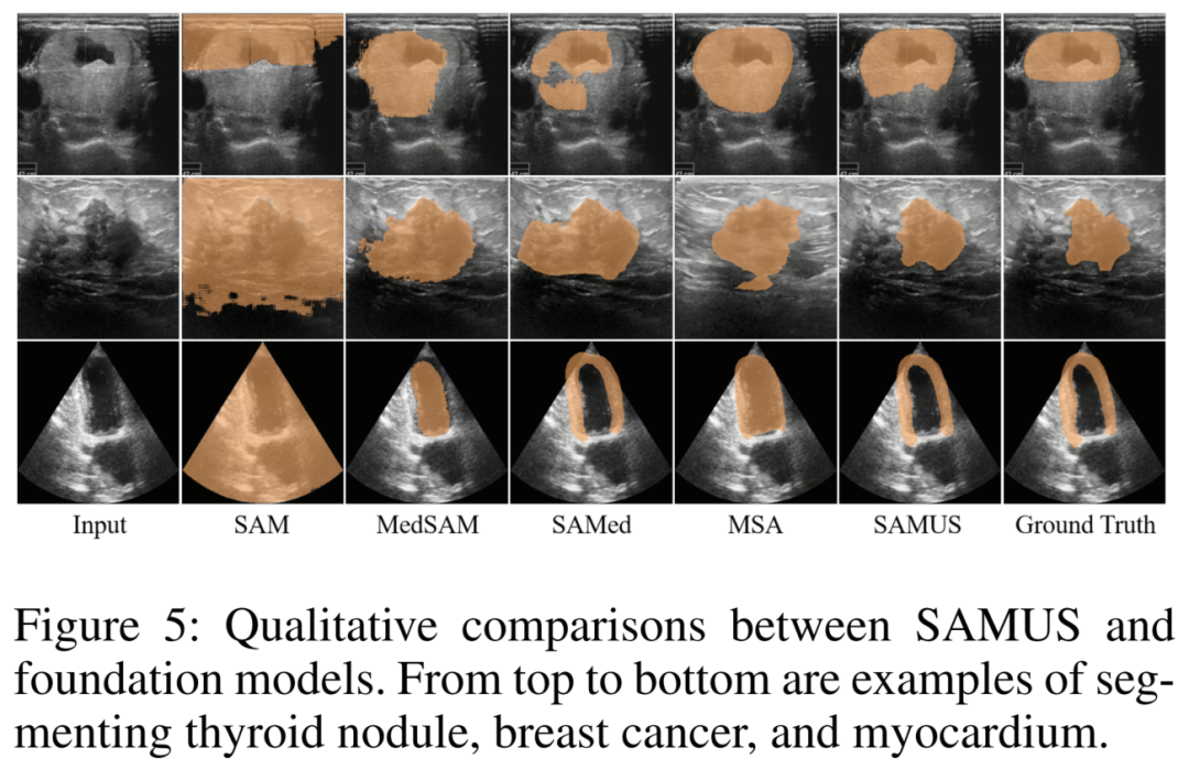 SAMed/MedSAM以及SwinUNet都不敌，SAMUS才是UNet与SAM结合的正确的道路，一路SOTA没对手！