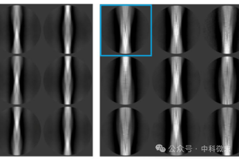 “僵尸鹿”卷土重来，恐怖表象源于何种分子结构？