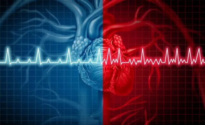Polygenic Risk Score Predicts Risk for Sudden Cardiac Death | Inside Precision Medicine