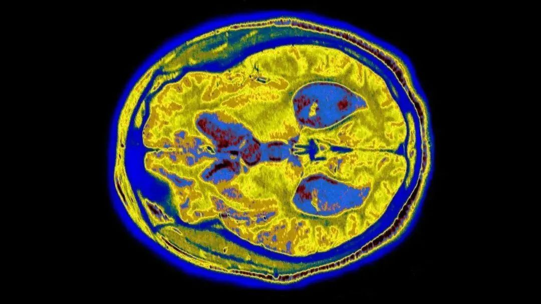 Science公布2023年度十大科学突破，减肥药GLP-1位列榜首