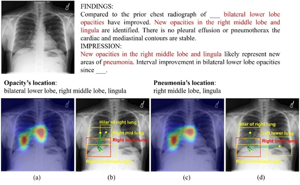放射科医生再临危机！国外五大机构联合发布「胸部X光」最新基准