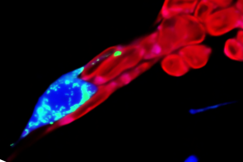 1218NewsFeature_BOTY_RUs-BDs_FF!@#$%^&_()_ +33.png