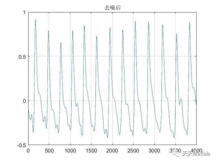 【信号去噪】基于小波变换实现脉搏信号去噪附Matlab代码