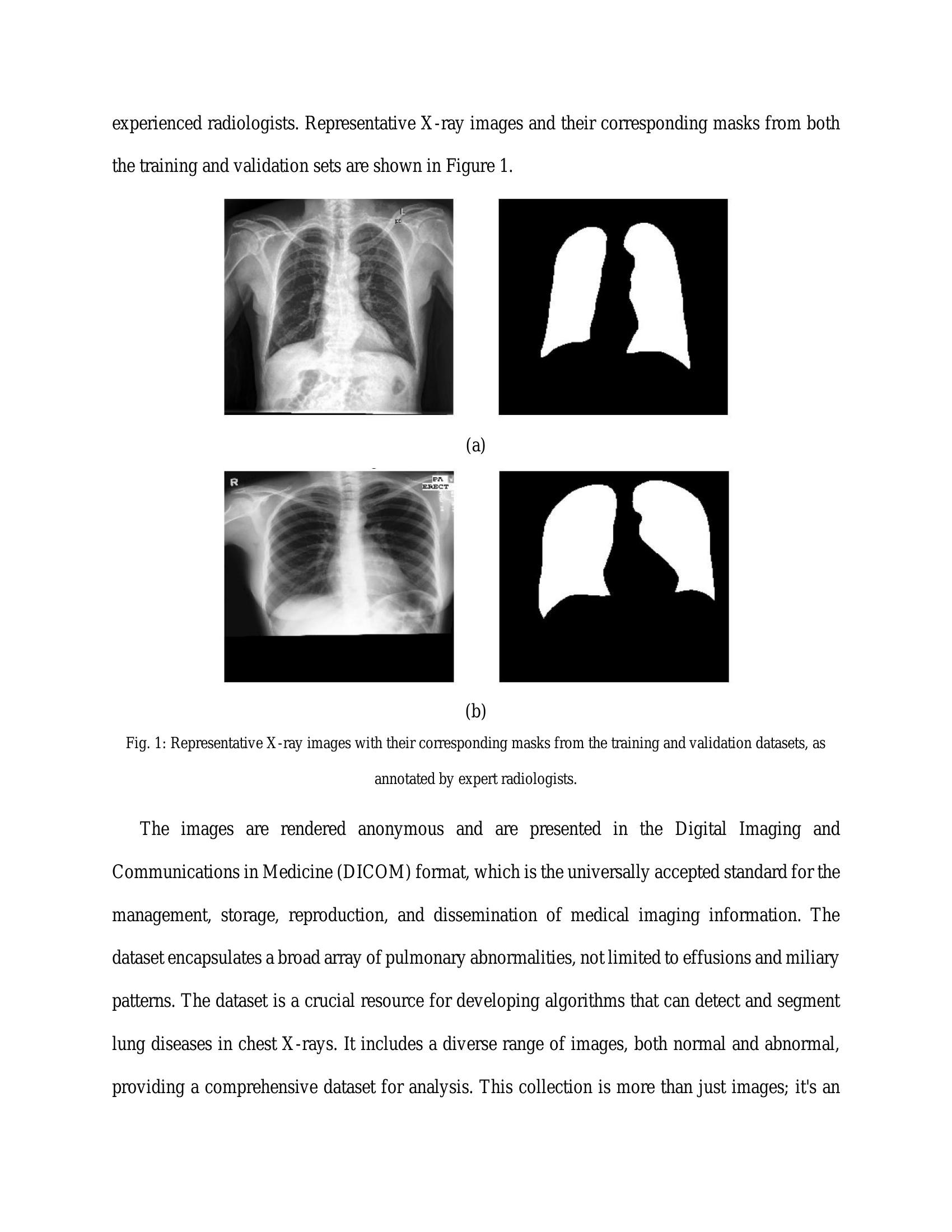 A Novel Approach to Chest X-ray Lung Segmentation Using U-net and ...