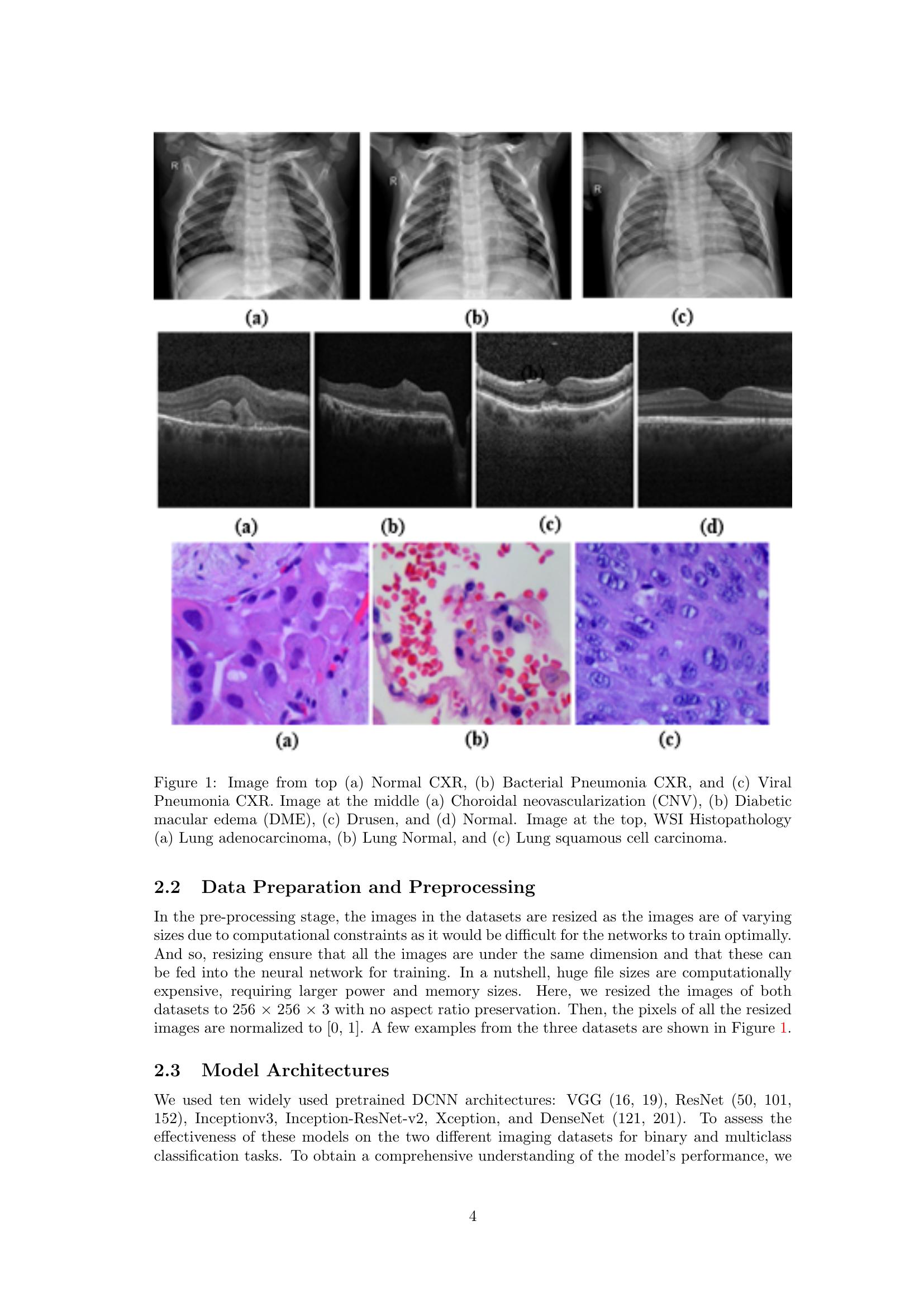 Disease Classification and Impact of Pretrained Deep Convolution Neural ...