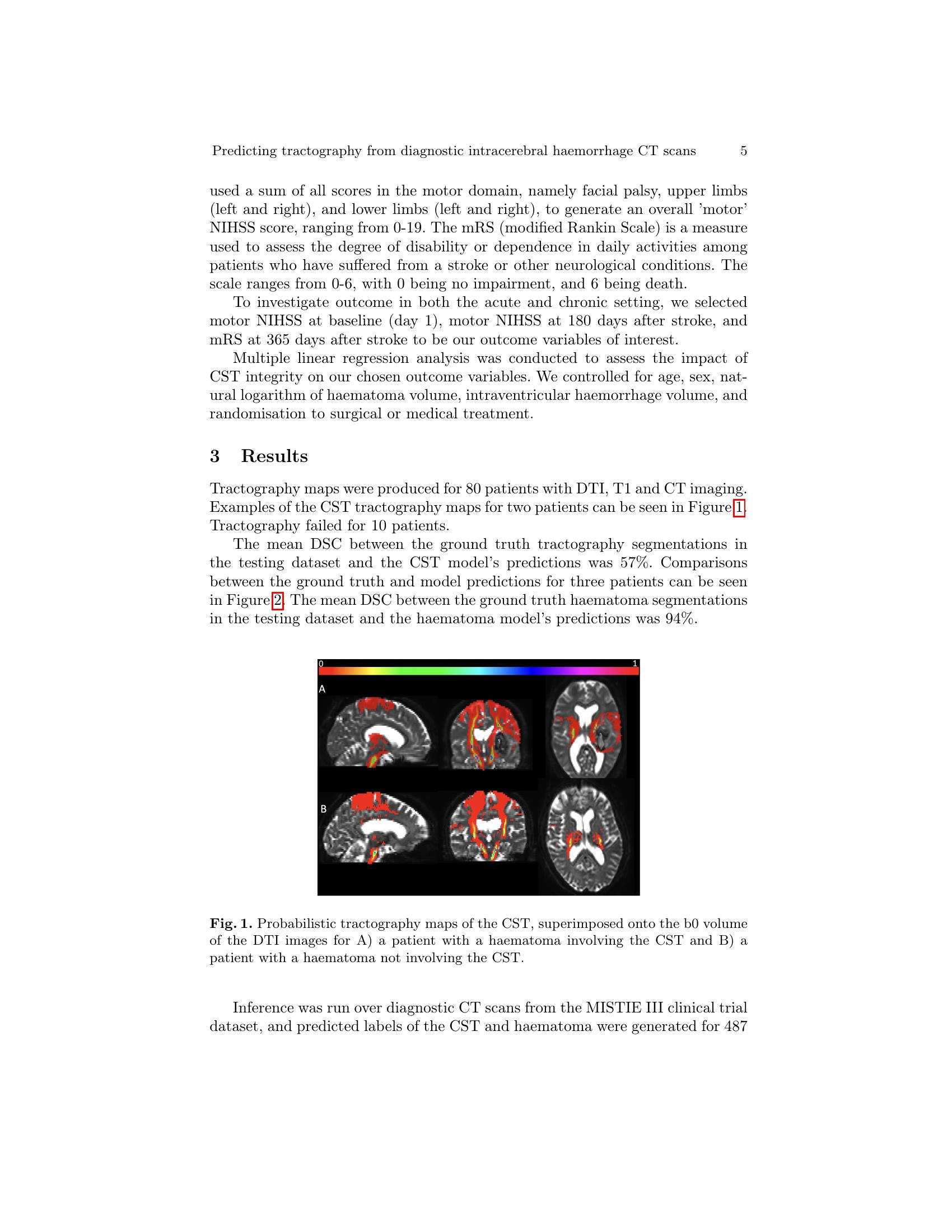 From Diagnostic CT to DTI Tractography labels: Using Deep Learning for ...